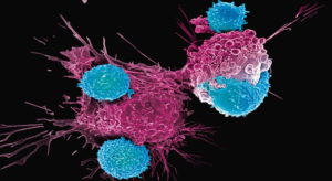 Read more about the article Celule T – tratament universal pentru toate tipurile de cancer