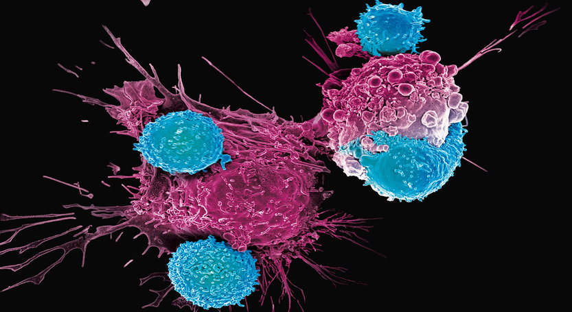 You are currently viewing Celule T – tratament universal pentru toate tipurile de cancer