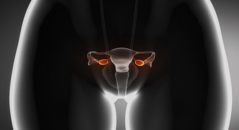 Un nou studiu confirma indicii pentru combaterea cancerului ovarian!